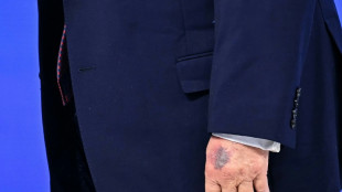 Trump atribuye moretones en su mano a golpe contra la mesa