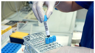 Cos&igrave; il sistema immunitario pu&ograve; favorire la crescita dei tumori