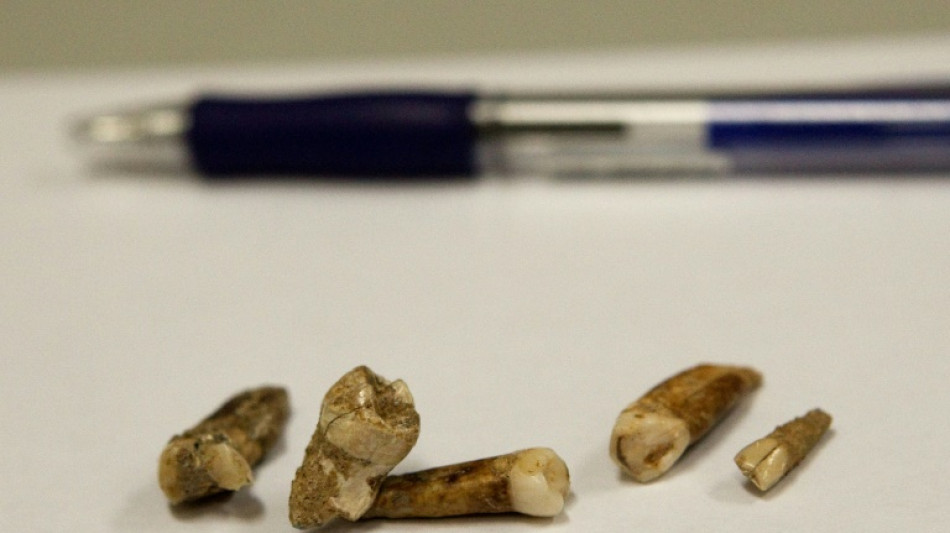 12.000 Jahre alte Z&auml;hne von Kind aus Steinzeit in Nordrhein-Westfalen entdeckt