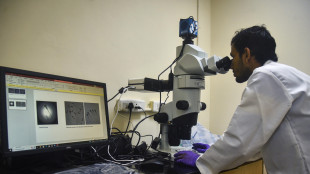 Scoperto nuovo meccanismo che regola la perdita di sinapsi nell'Alzheimer