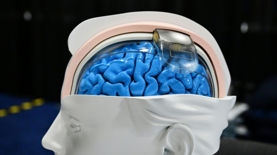 Revolu&ccedil;&atilde;o da neurotecnologia transforma fic&ccedil;&atilde;o cient&iacute;fica em realidade