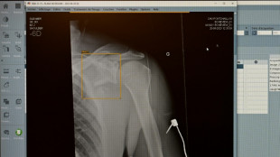 Barmer-Umfrage: Mehrheit gegen&uuml;ber KI-Einsatz in Medizin aufgeschlossen