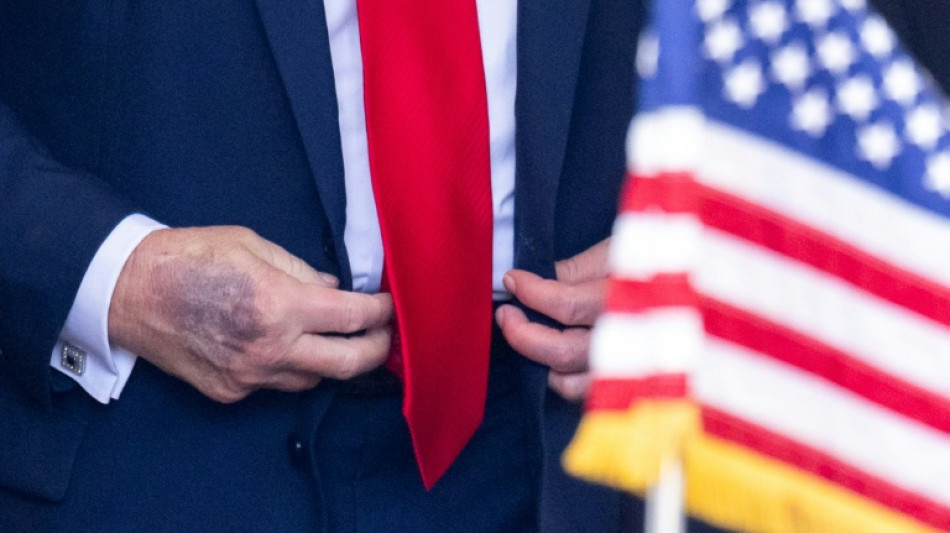 Trump insiste em seu 'perfeito' estado de sa&uacute;de