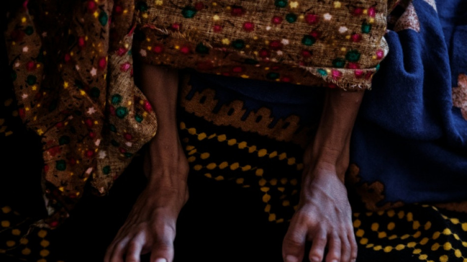 El hambre en niveles cr&iacute;ticos casi se duplica en Somalia