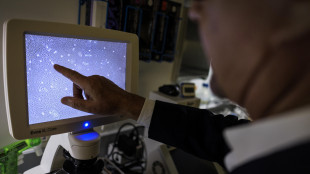 Proteine disordinate progettate su misura con l'aiuto dell'IA