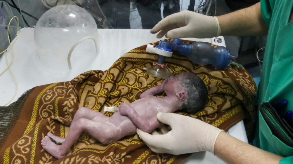 M&eacute;dicos de Gaza salvan a una beb&eacute; realizando una ces&aacute;rea a su madre agonizante