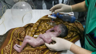 M&eacute;dicos de Gaza salvan a una beb&eacute; realizando una ces&aacute;rea a su madre agonizante