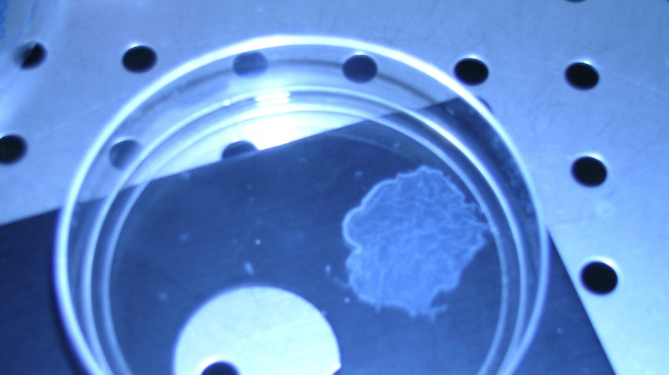 C'è un legame tra rigidità dei tessuti e progressione dei tumori