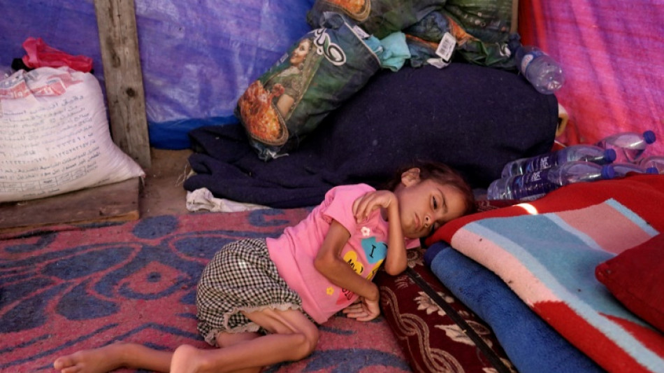 Uno de cada 4 ni&ntilde;os menores de 5 a&ntilde;os sufre "pobreza alimentaria severa", seg&uacute;n Unicef