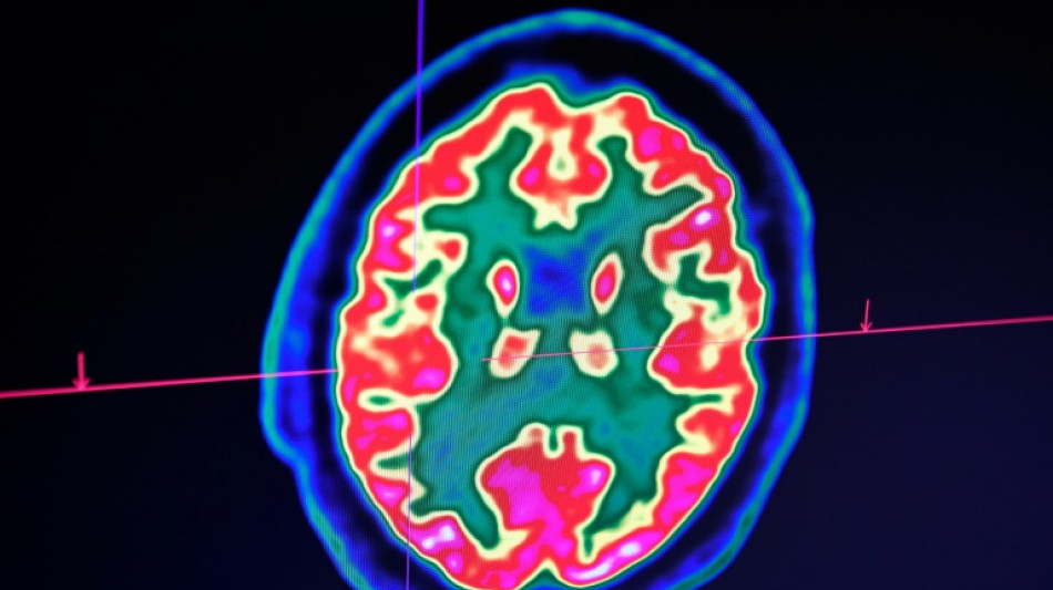 La curaci&oacute;n de un ni&ntilde;o con tumor cerebral llena de optimismo a los cient&iacute;ficos