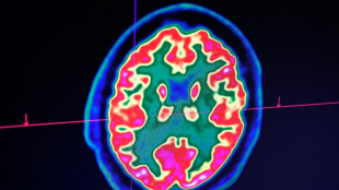 La curaci&oacute;n de un ni&ntilde;o con tumor cerebral llena de optimismo a los cient&iacute;ficos